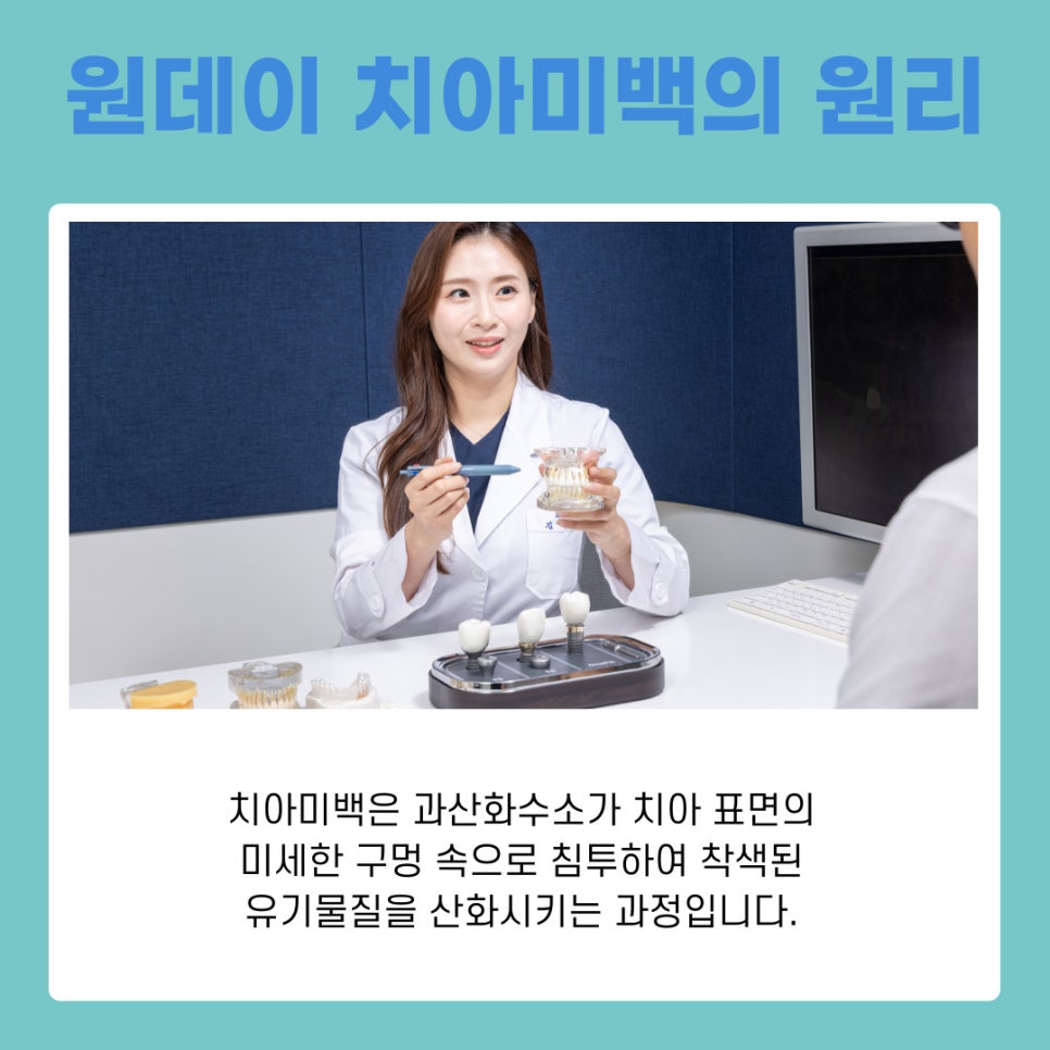 One-Day Teeth Whitening Procedure: A Bright Smile Completed in Just One Day image 6
