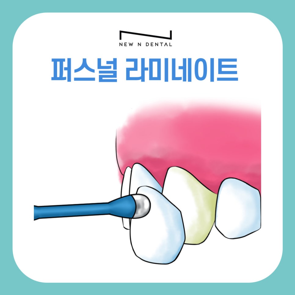 강남 라미네이트 퍼스널 자연스러움의 기준이 달라졌습니다 관련 이미지 2