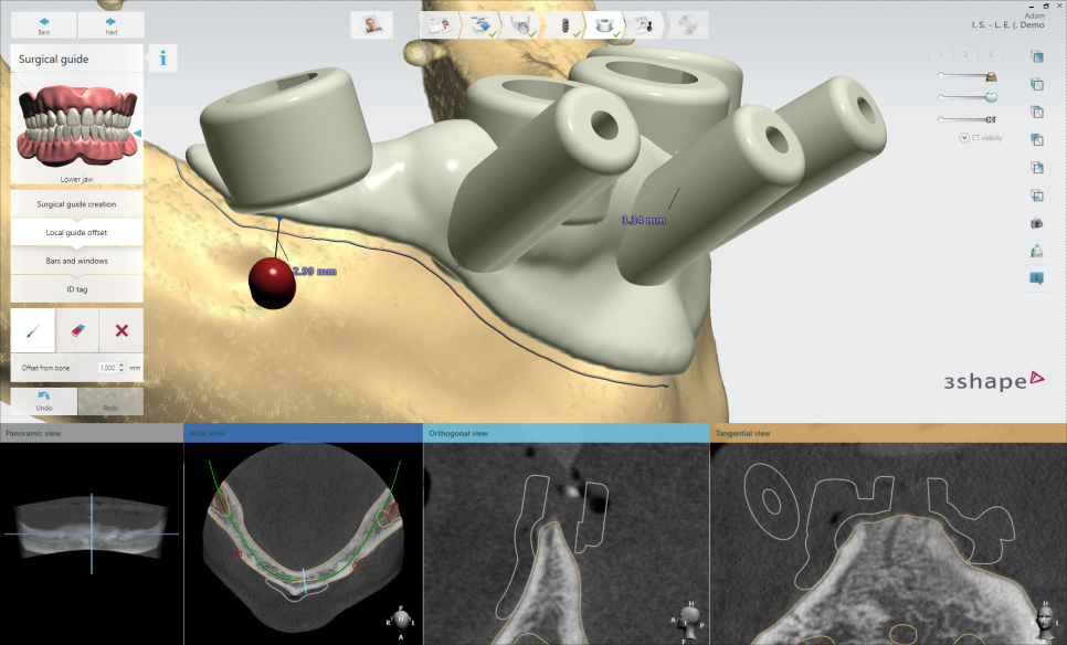 논현동임플란트치과 경험이 풍부한 곳 관련 이미지 7