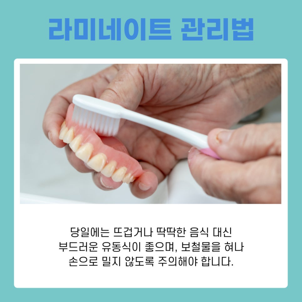 강남역 라미네이트치과 무삭제로 자연치아 지키는 법 관련 이미지 10