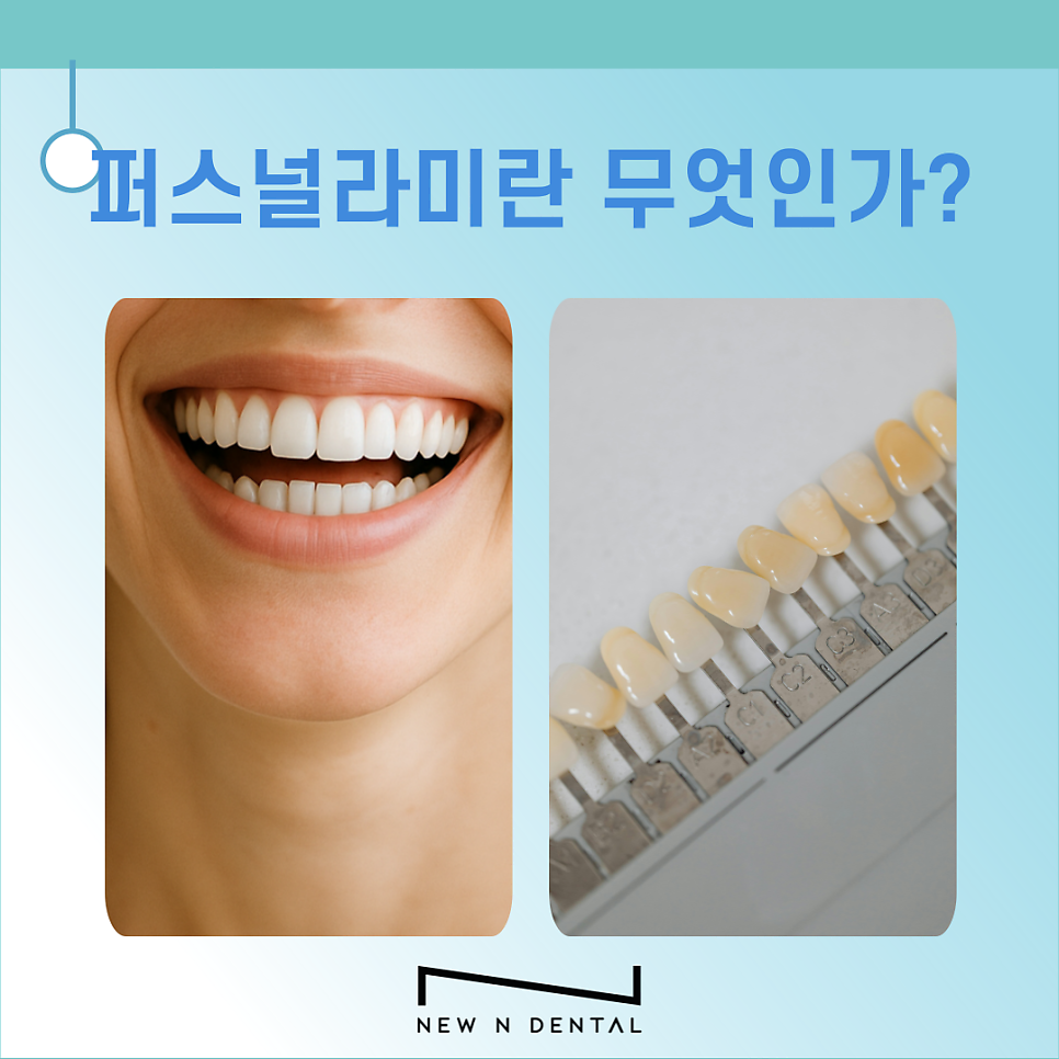 퍼스널라미 적용시키면 좋은 치아는? 관련 이미지 3