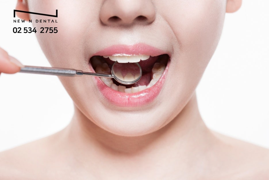 서울임플란트잘하는곳 치아의 길 찾기 관련 이미지 6