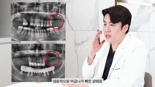 강남임플란트치과 시작하는 새로운 인생 관련 이미지 3