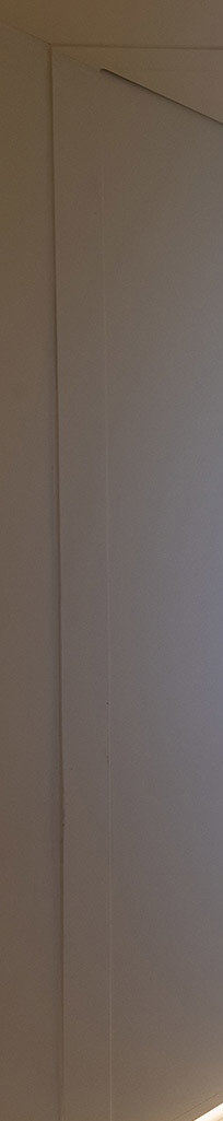 앞니심미치료로 되찾는 자연스러운 스마일 라인 관련 이미지 15