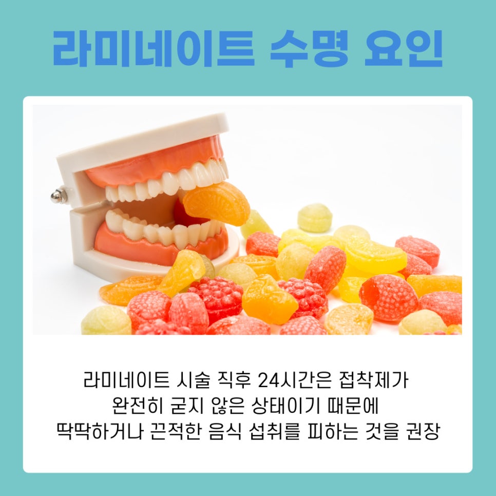 라미네이트 오래 유지하려면 알아야 할 점 관련 이미지 7