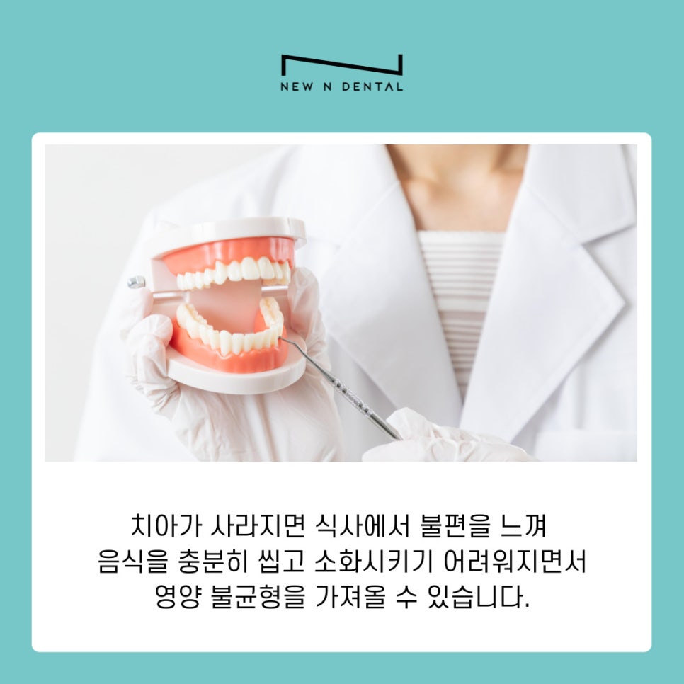 강남역치과 임플란트 시행하는 원인과 고려할 사항 관련 이미지 4