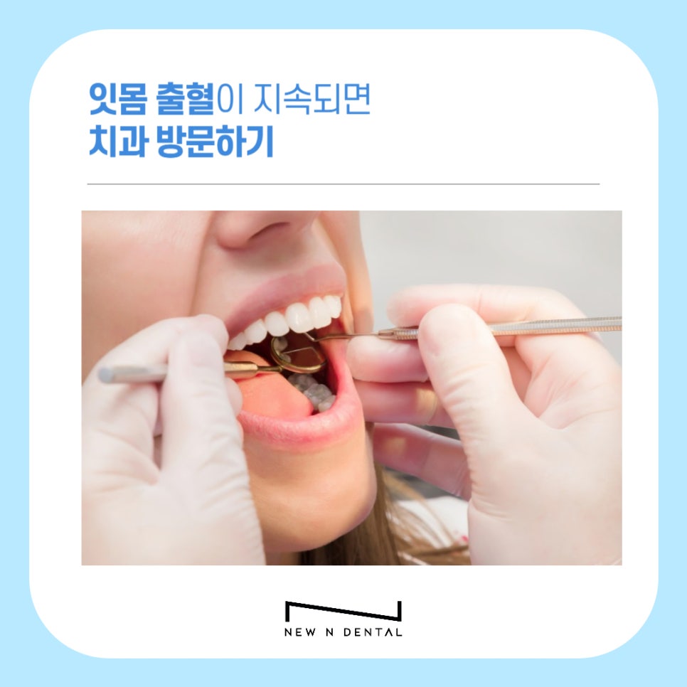 치간칫솔 치아관리 올바르게 사용하려면 관련 이미지 10