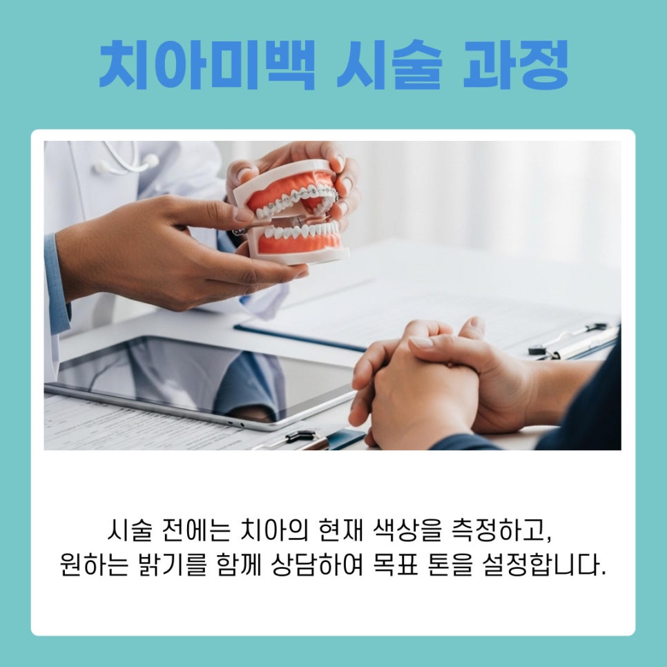 강남역치과추천 시간 없는 직장인도 가능한 원데이치아미백 관련 이미지 6