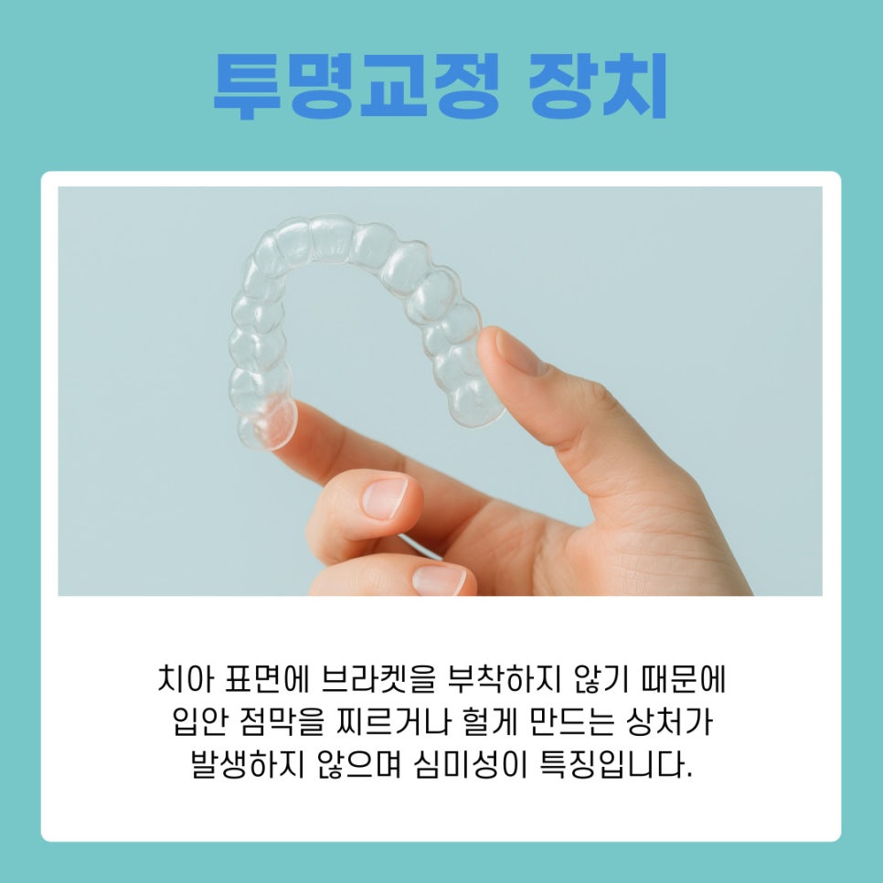 Understanding the Characteristics of Different Types of Orthodontic Appliances at Gangnam Orthodontic Clinics image 10