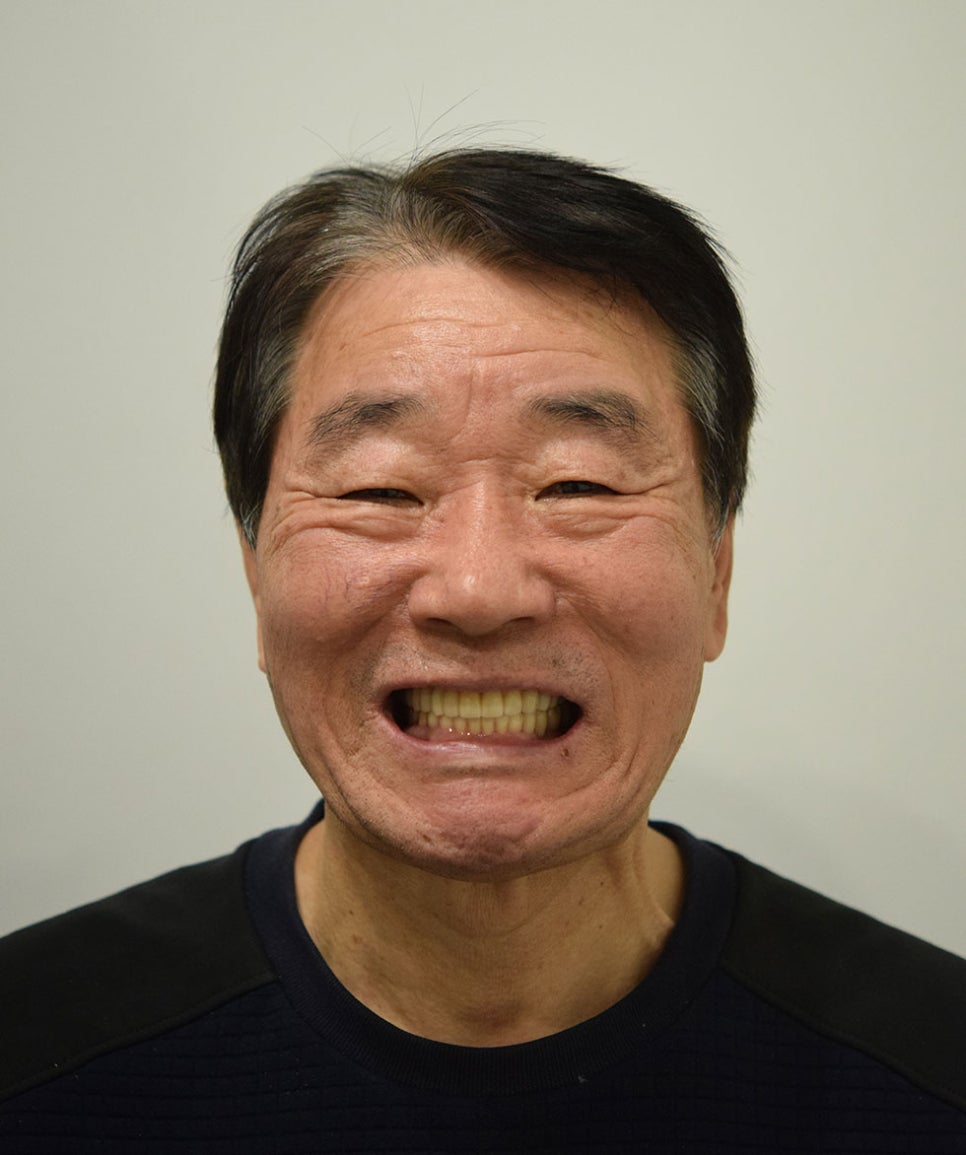 역삼동임플란트추천 치아를 건강하게 관련 이미지 9