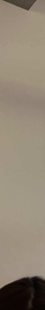 강남치아교정치과 이젠 밝게 웃을 수 있는 관련 이미지 18