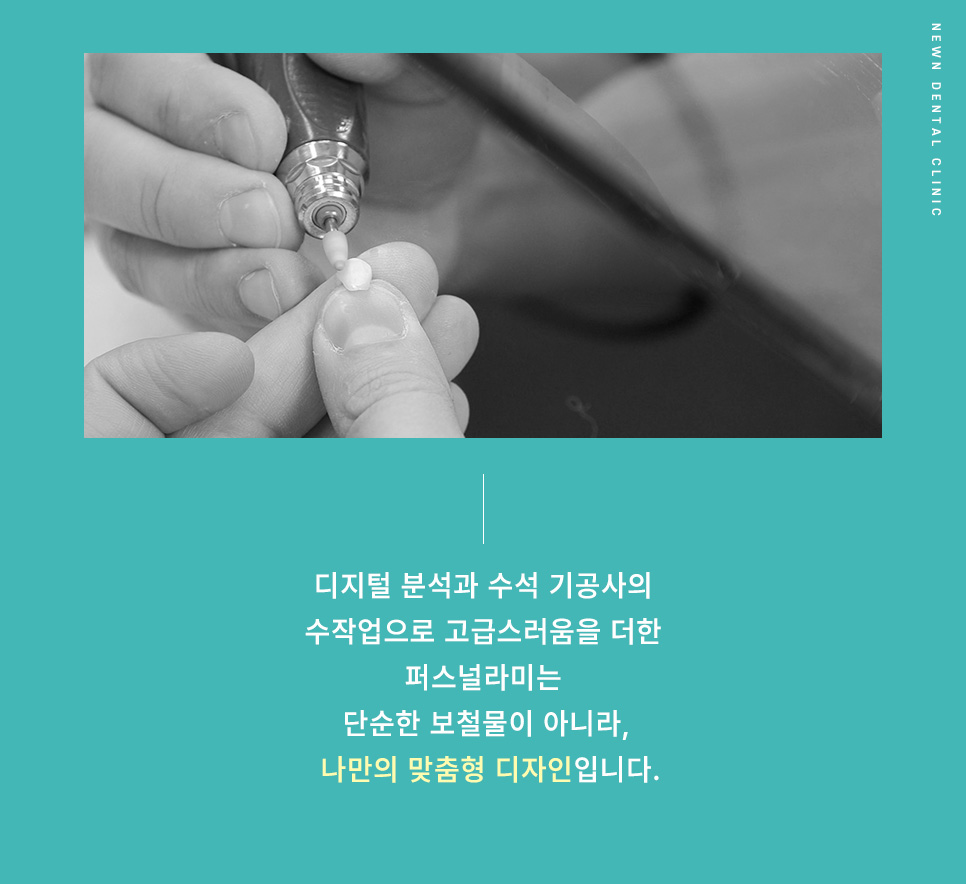 [뉴엔치과] 강남역 나에게 맞는 스마일 디자인,퍼스널라미 제로와 네츄럴 관련 이미지 9