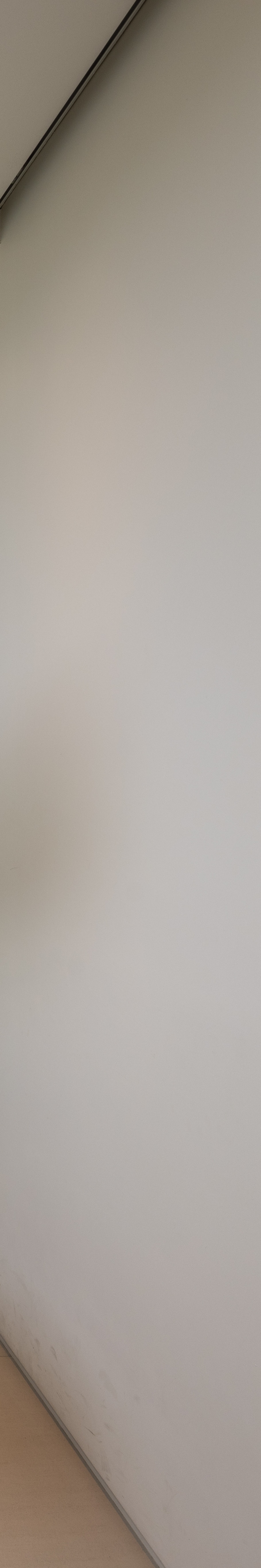 강남역치과추천 치아 삭제 않고 완벽한 미소로 관련 이미지 32