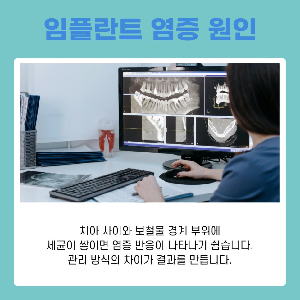 역삼동 임플란트 염증 초기 원인부터 예방법까지 한 번에 보기 관련 이미지 4