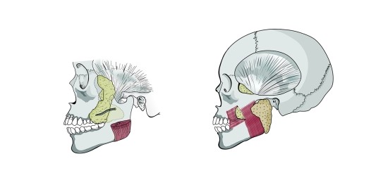 Deep Cheek Fat Removal image 1