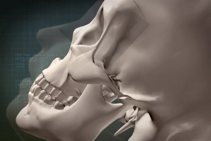 Understanding the Structure of the Cheekbone and Cheekbone Reduction Surgery image 17
