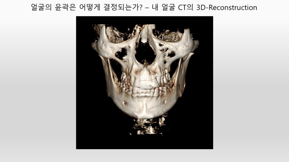 안면윤곽 개선에 관한 단계별 제안 관련 이미지 1