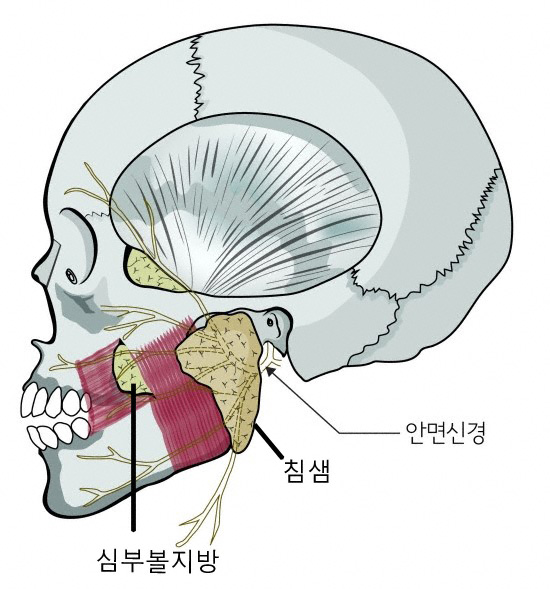 양악수술과 심부볼지방제거 관련 이미지 3