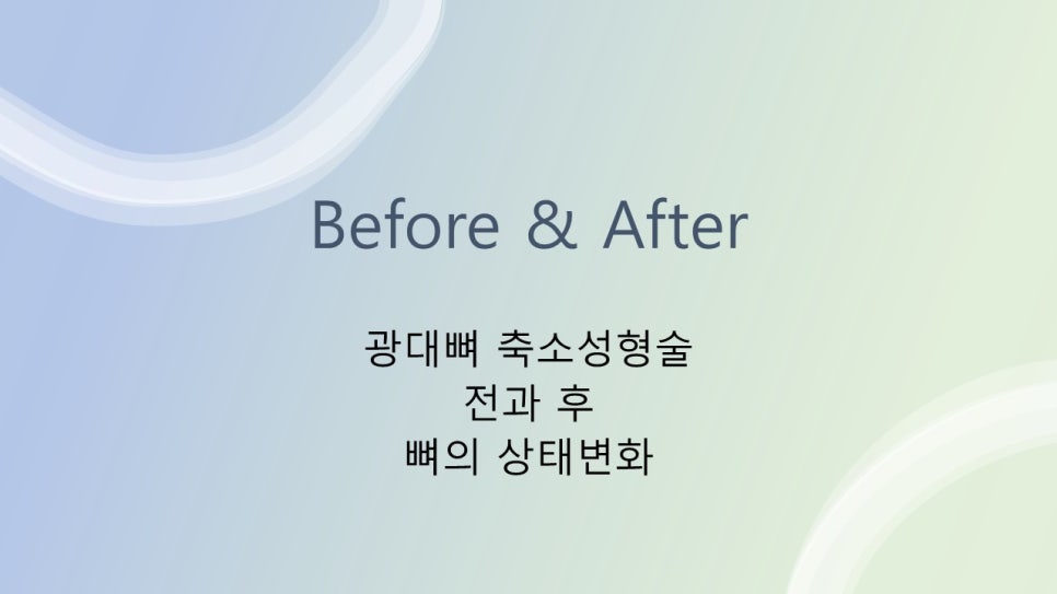 안면윤곽수술후 모습이 바뀌어 보이려면 얼마나 기다려야 할까? "윤곽수술과 술후 다운타임및 술후 관리방법" 관련 이미지 28