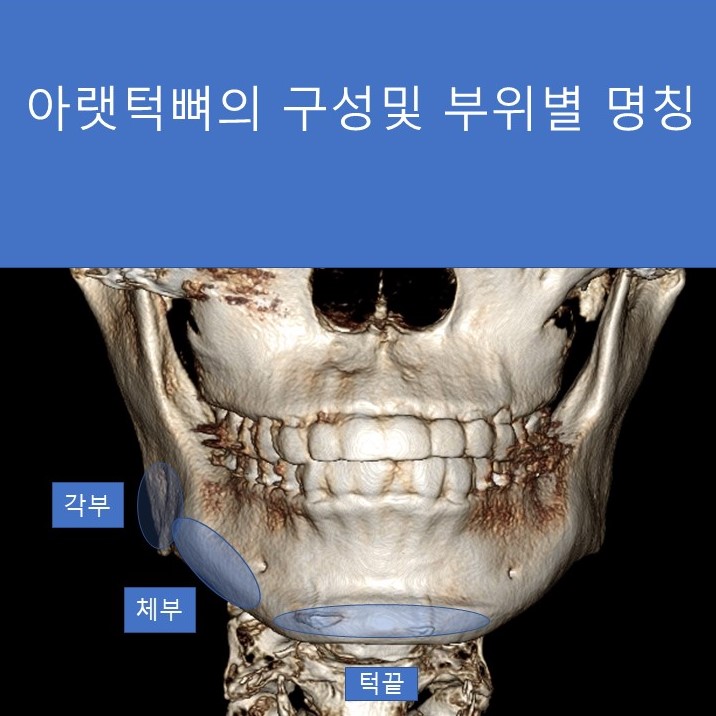 사각턱 수술과 피질골 절제에 관한 심층적 고찰 관련 이미지 1