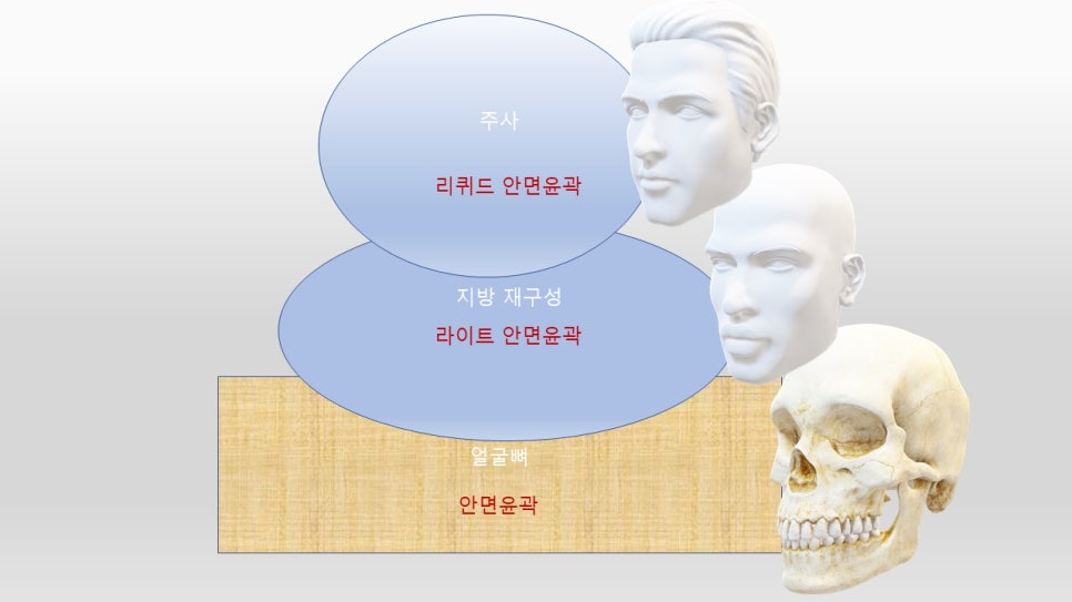 안면윤곽 개선에 관한 단계별 제안 관련 이미지 4