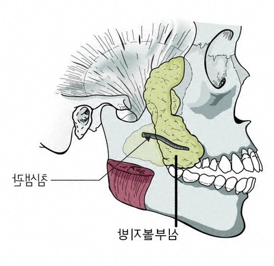 안면윤곽수술에 관한 연재 - 1. 심부볼지방제거 수술 관련 이미지 3