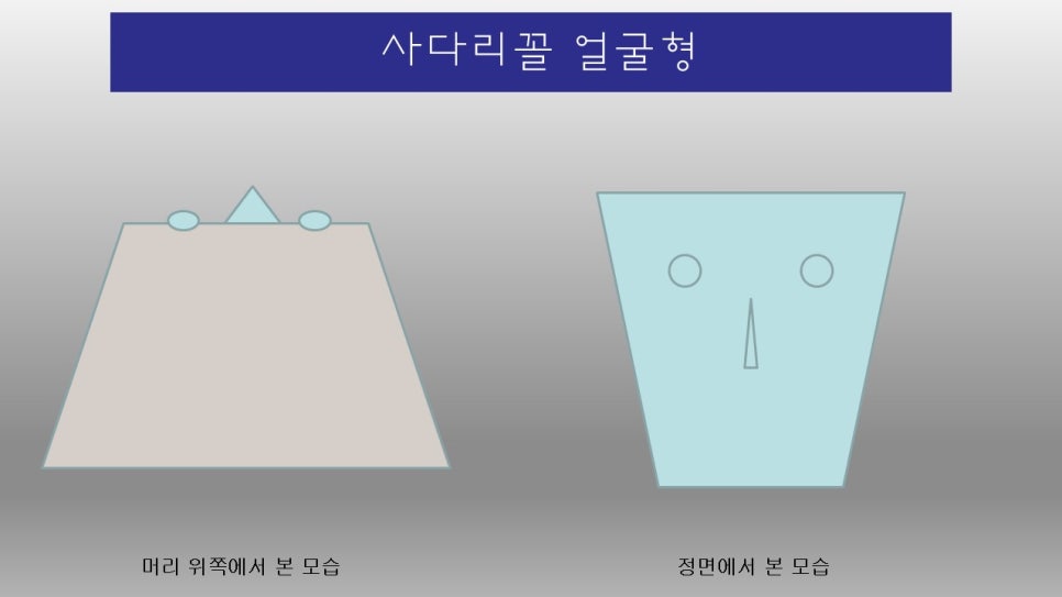 광대뼈 성형술후 사다리꼴 얼굴형? 관련 이미지 1