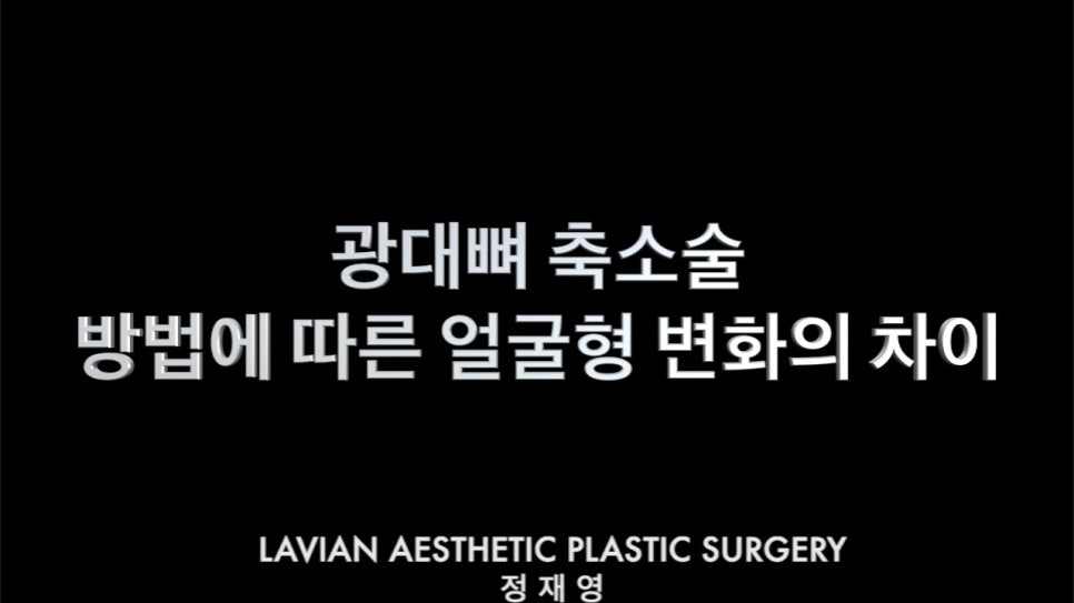 Why Do So Many People Consider Revision Surgery After Zygomatic Reduction Surgery? image 1