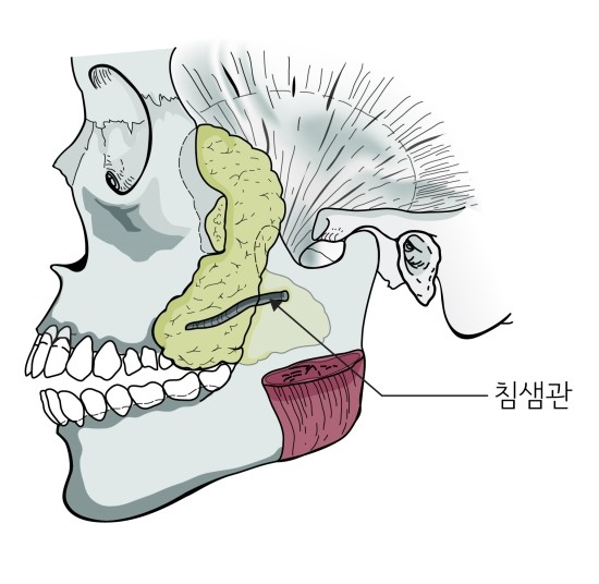 심부볼지방제거시 주의해야 할 사항과 가능한 부작용 관련 이미지 1