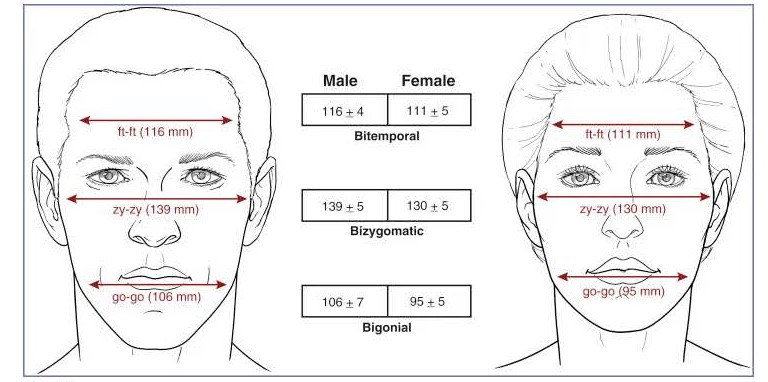 Zygoma Reduction Surgery for a More Three-Dimensional Face image 1