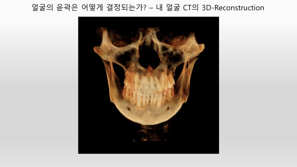 안면윤곽 개선에 관한 단계별 제안 관련 이미지 2