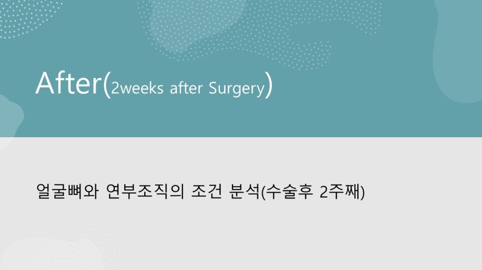 안면윤곽수술후 모습이 바뀌어 보이려면 얼마나 기다려야 할까? "윤곽수술과 술후 다운타임및 술후 관리방법" 관련 이미지 17