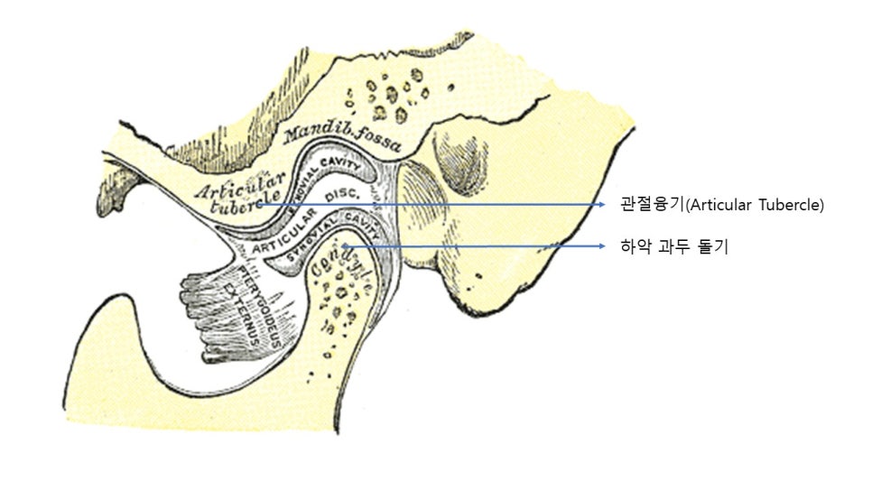 광대뼈축소성형술-후방광대 혹은 뒷광대 축소술에 관한 이해 1.개론 관련 이미지 5