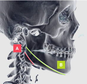 The Uncomfortable Truth About Square Jaw Surgery image 1