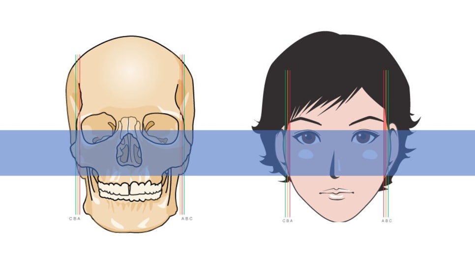 How Is Face Shape Determined? Factors That Determine Face Shape and Facial Contouring Surgery image 16