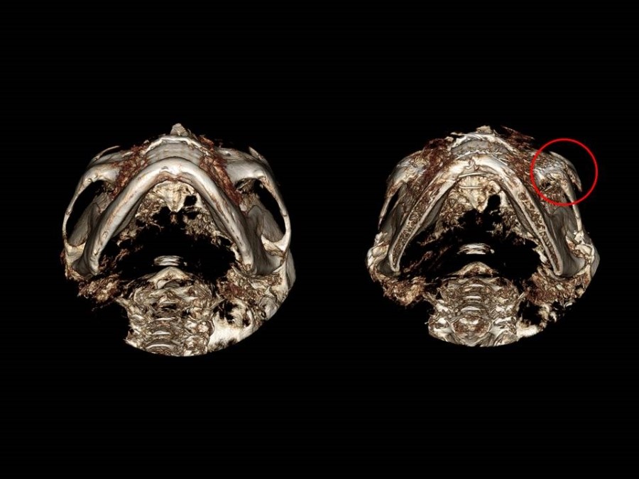 Zygoma Reduction Surgery Through Complete Osteotomy of the Body and Arch image 24
