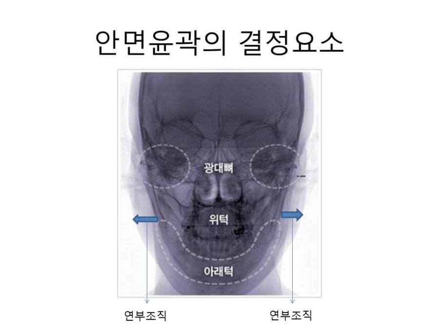 The Impact of Buccal Fat on Facial Contours image 1