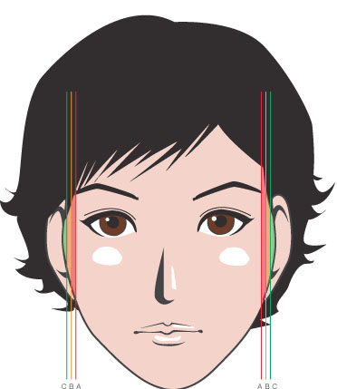 Understanding the Structure of the Cheekbone and Cheekbone Reduction Surgery image 8