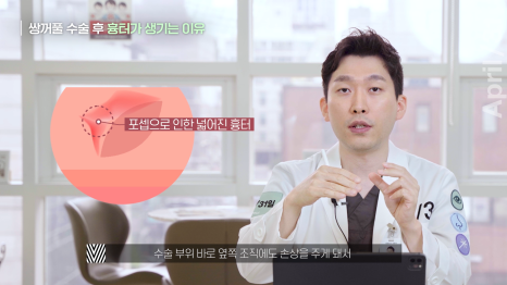 [Eye Plastic Surgery] The Dark and Light Sides of Eye Plastic Surgery - About Scars from Double Eyelid Surgery image 7