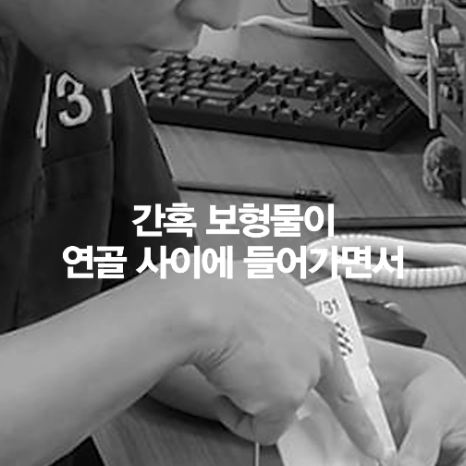[4월31일성형외과] 코 성형했는데 왜 코끝이 뭉툭해 보일까요? 관련 이미지 14