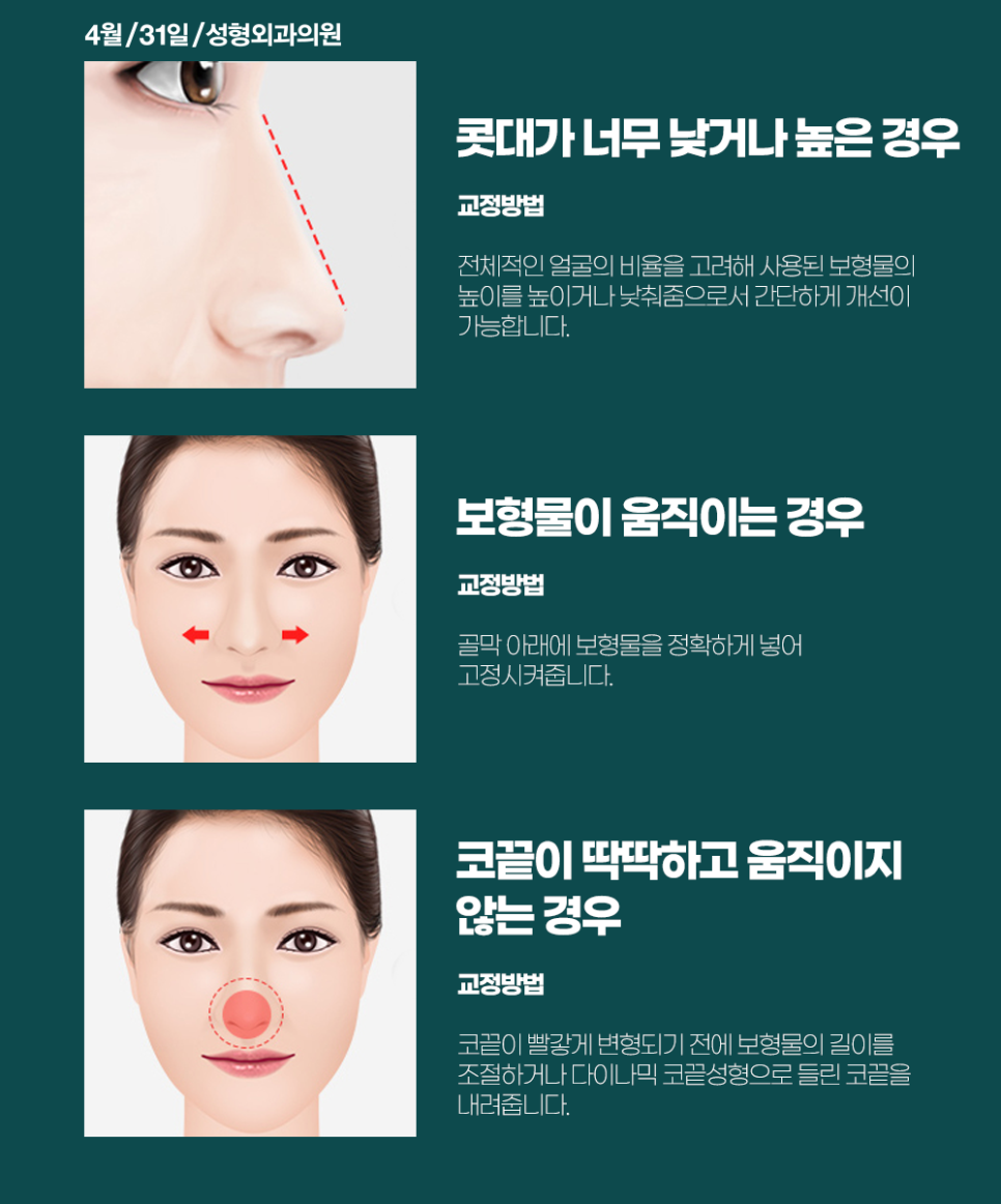코재수술성형외과추천 마지막코성형은 431에서! 관련 이미지 5