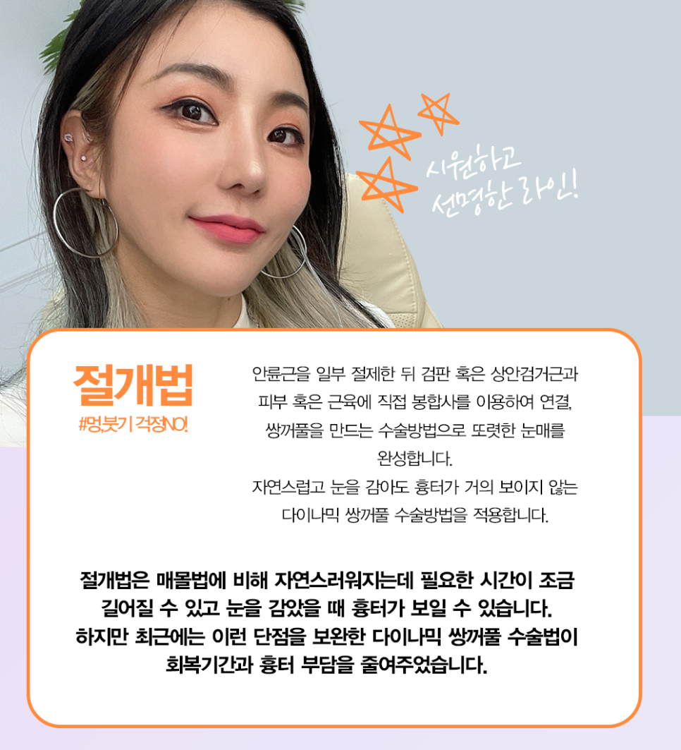 쌍수추천병원 에서 말하는 눈성형종류 관련 이미지 4