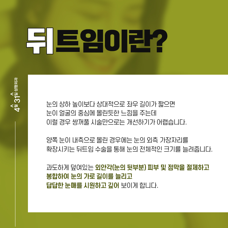 눈뒤트임수술 자연스럽게 4월31일성형외과 관련 이미지 2