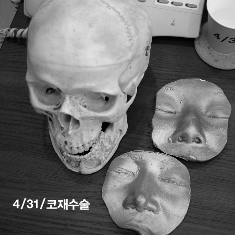 20 Years of Know-How, 4월31일성형외과, a Famous Hospital for Nose Revision Surgery image 5