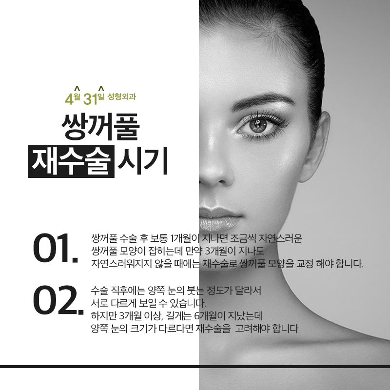 강남쌍꺼풀재수술비용 부담없이 4월31일성형외과에서 관련 이미지 4