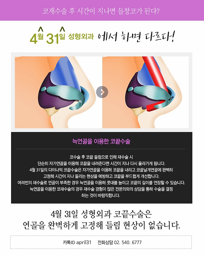 코재수술성형외과 잘하는곳 찾고있나요? 관련 이미지 4