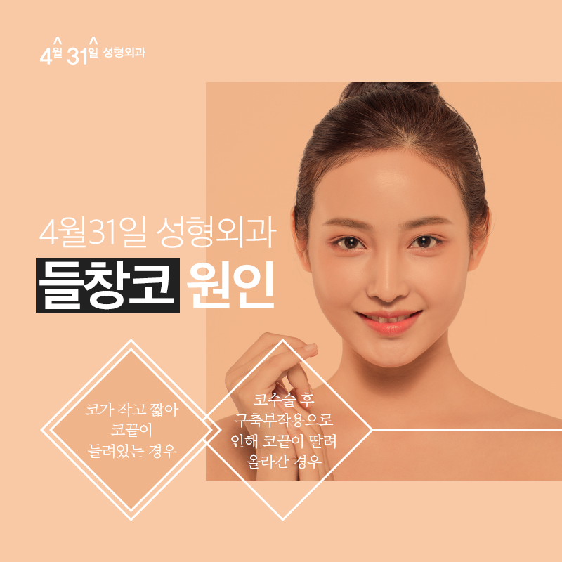 들창코수술비용 부담스럽지 않게 관련 이미지 2