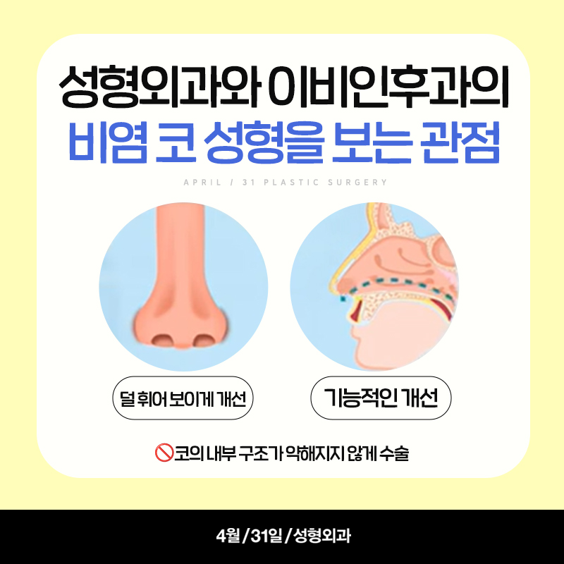 [코성형] 기능&미용 모두를 잡는 비염 코성형! 관련 이미지 4