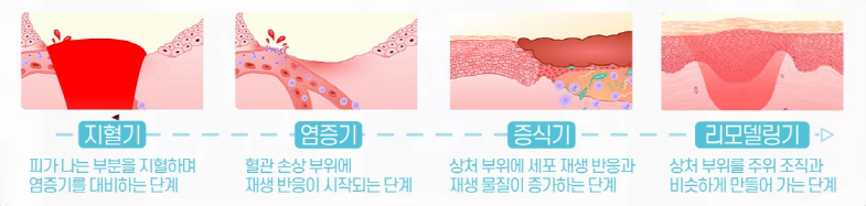 [Eye Plastic Surgery] The Dark and Light Sides of Eye Plastic Surgery - About Scars from Double Eyelid Surgery image 4