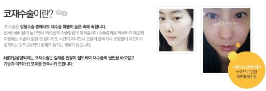 코성형 재수술 전문 신뢰할수 있는곳! 관련 이미지 3